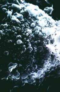 Рис. 5. Т-лимфоцит, инфицированный ВИЧ. ВИЧ использует Т-лимфоциты для своего размножения (частицы вируса выглядят как маленькие шарики [Вебер Д., Вейсс Р., 1988]). Одновременно он разрушает иммунную систему хозяина, что делает невозможным существование большого количества ВИЧ-инфицированных людей в условиях, когда их популяции подвергаются давлению со стороны возбудителей контагиозных болезней. Победа над контагиозными возбудителями привела не к переходу их в комменсалы, а к их смене паразитом с другой стратегией паразитизма. И в настоящее время использующий вторую стратегию паразитизма ВИЧ — наиболее идеальный убийца