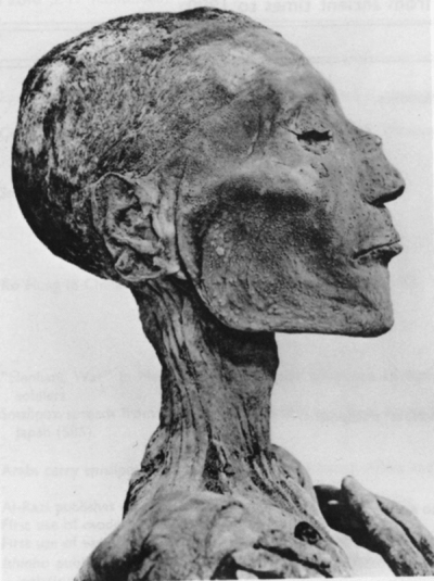 Рис. 3.92. Мумия фараона Рамзеса V, умершего в 1157 г. до н. э.
